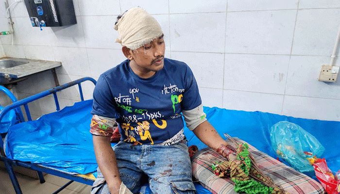 জমিসংক্রান্ত বিরোধের হামলায় একজন টেঁটাবিদ্ধ