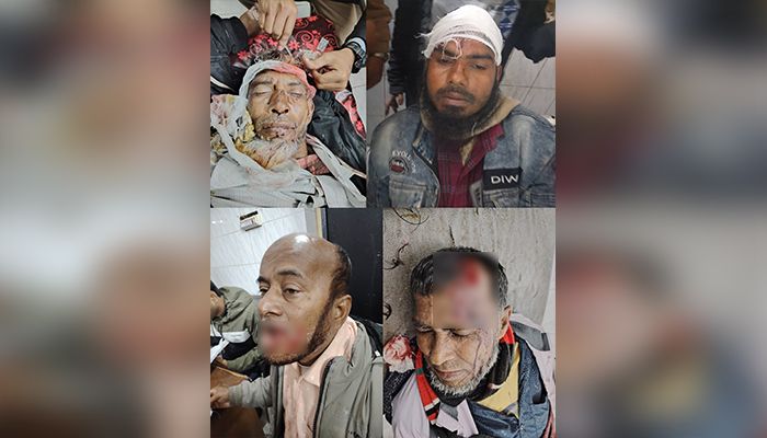 লালমোহনে বিএনপি-জামায়াতের সংঘর্ষে আহত ৩০