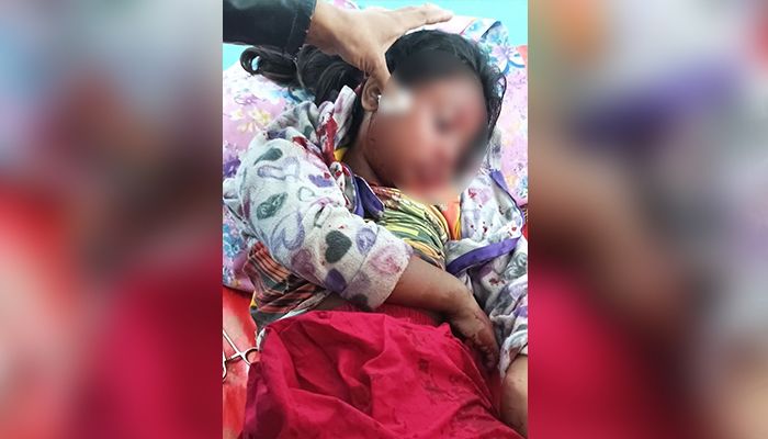 মিয়ানমার থেকে ছোঁড়া গুলিতে আহত শিশুটি বেঁচে আছে
