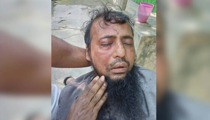 জামায়াত কর্মীর দাড়ি ধরে লাঠিপেটার অভিযোগ যুবদল কর্মীর বিরুদ্ধে