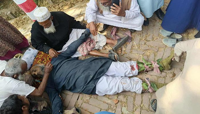 পাথরঘাটায় জামায়াত নেতার পা ভেঙে দিল দুর্বৃত্তরা