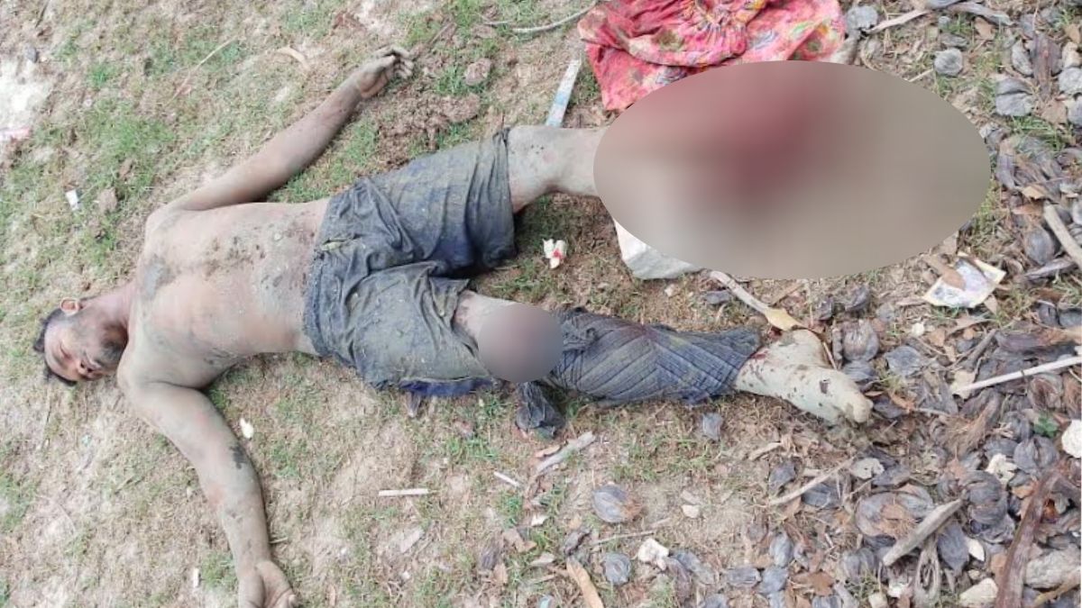 উখিয়া সীমান্তে মাইন বিস্ফোরণে রোহিঙ্গা যুবক আহত