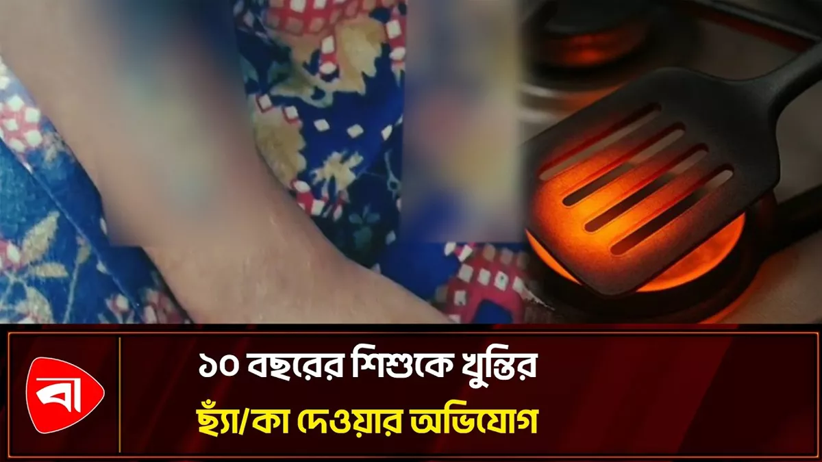 সৎ মায়ের বিরুদ্ধে ১০ বছরের শিশুকে খুন্তির ছ্যাঁকা দেওয়ার অভিযোগ 