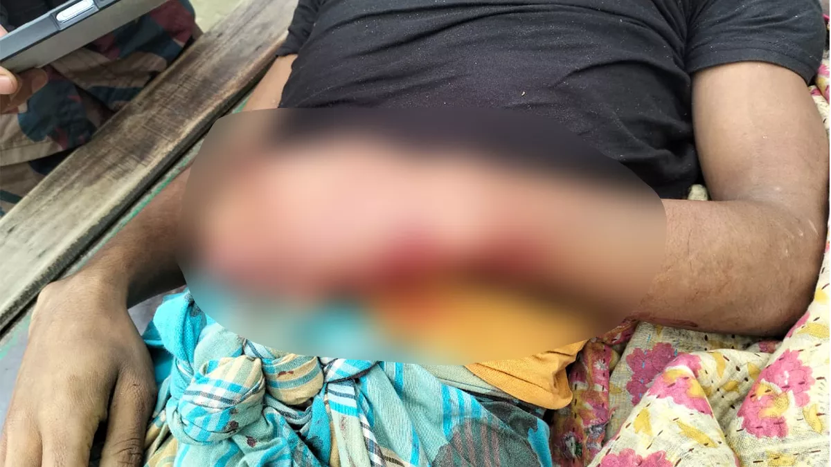  বিএসএফের গুলিতে বাংলাদেশি যুবক নিহত