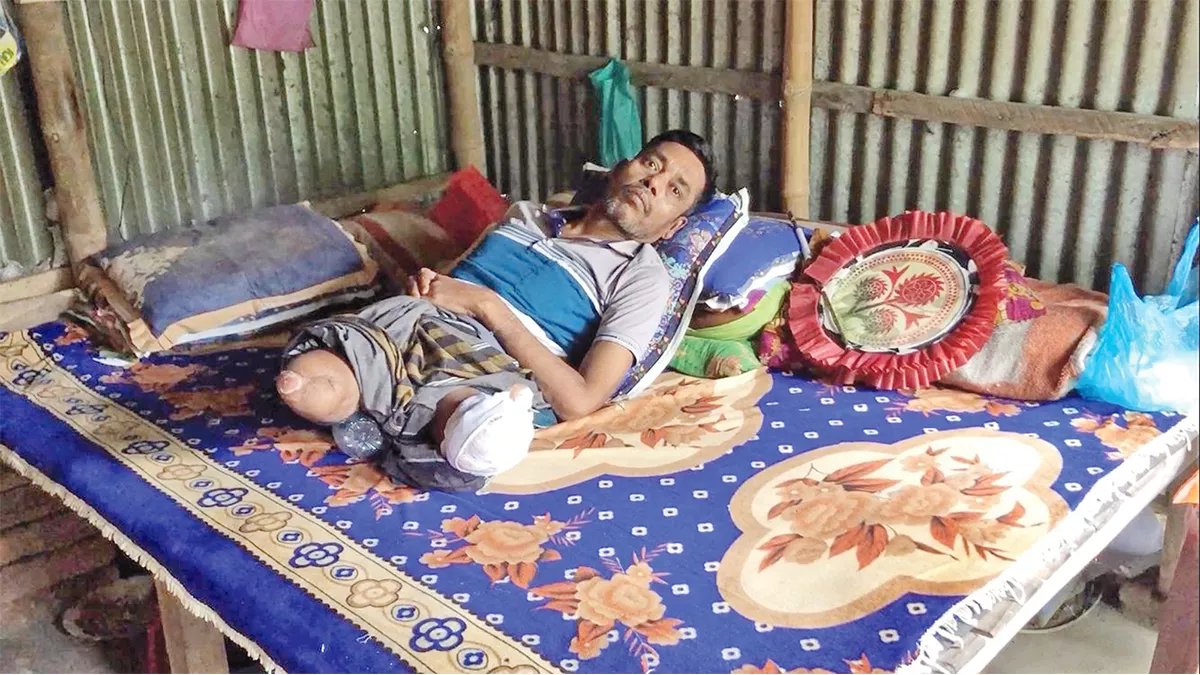 দুই পা হারিয়ে বিছানায় নুরুল ইসলাম 