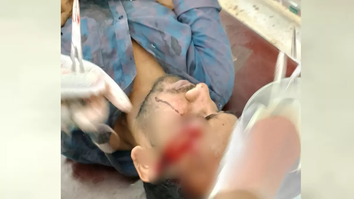 রাবি শিক্ষার্থীকে রড দিয়ে পেটানোর অভিযোগে আটক অটোচালক