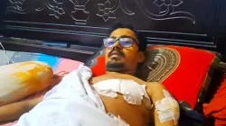 টাকা না দেওয়ায় ব্লেড দিয়ে হামলা, শরীরে ১৭২ সেলাই 