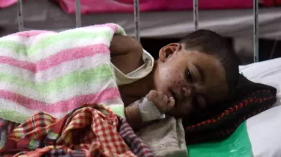 হাম: পাঁচদিনে নেই নিশ্চিত মৃত্যু, উপসর্গে ২৩