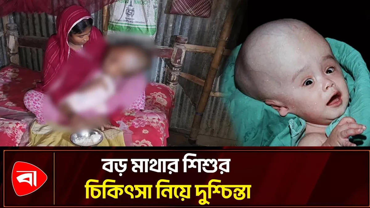 শিশু মুসলিমাকে বাঁচাতে অর্থ সহায়তা চায় পরিবার