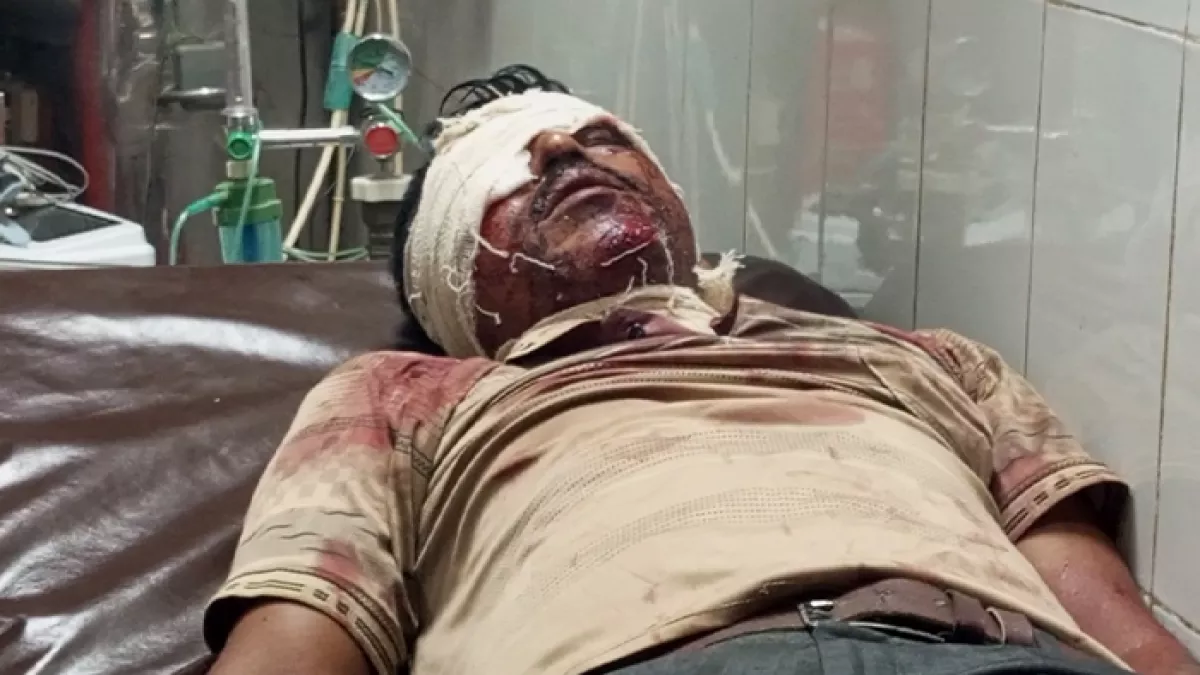 নওগাঁর বদলগাছীতে সিএনজিচালিত অটোরিকশা এবং মোটরবাইকের মুখোমুখি সংঘর্ষে উভয় চালক গুরুতর আহত হয়েছেন। প্রবা ফটো